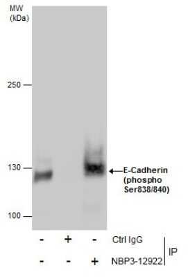 Immunoprecipitation: E-Cadherin [p Ser838, p Ser840] Antibody [NBP3-12922]